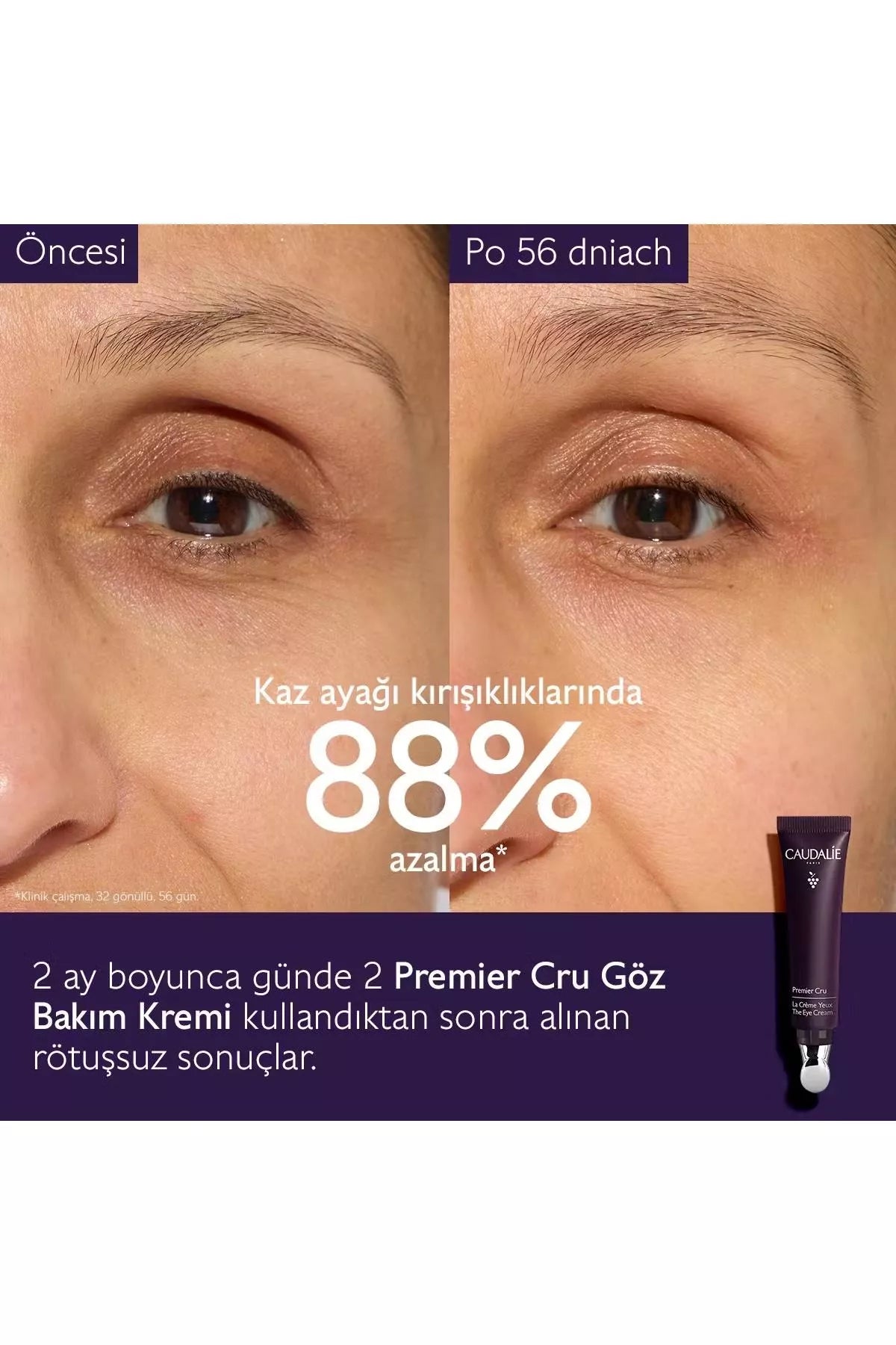 Urun gorseli