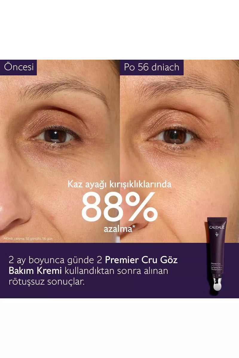 Urun gorseli