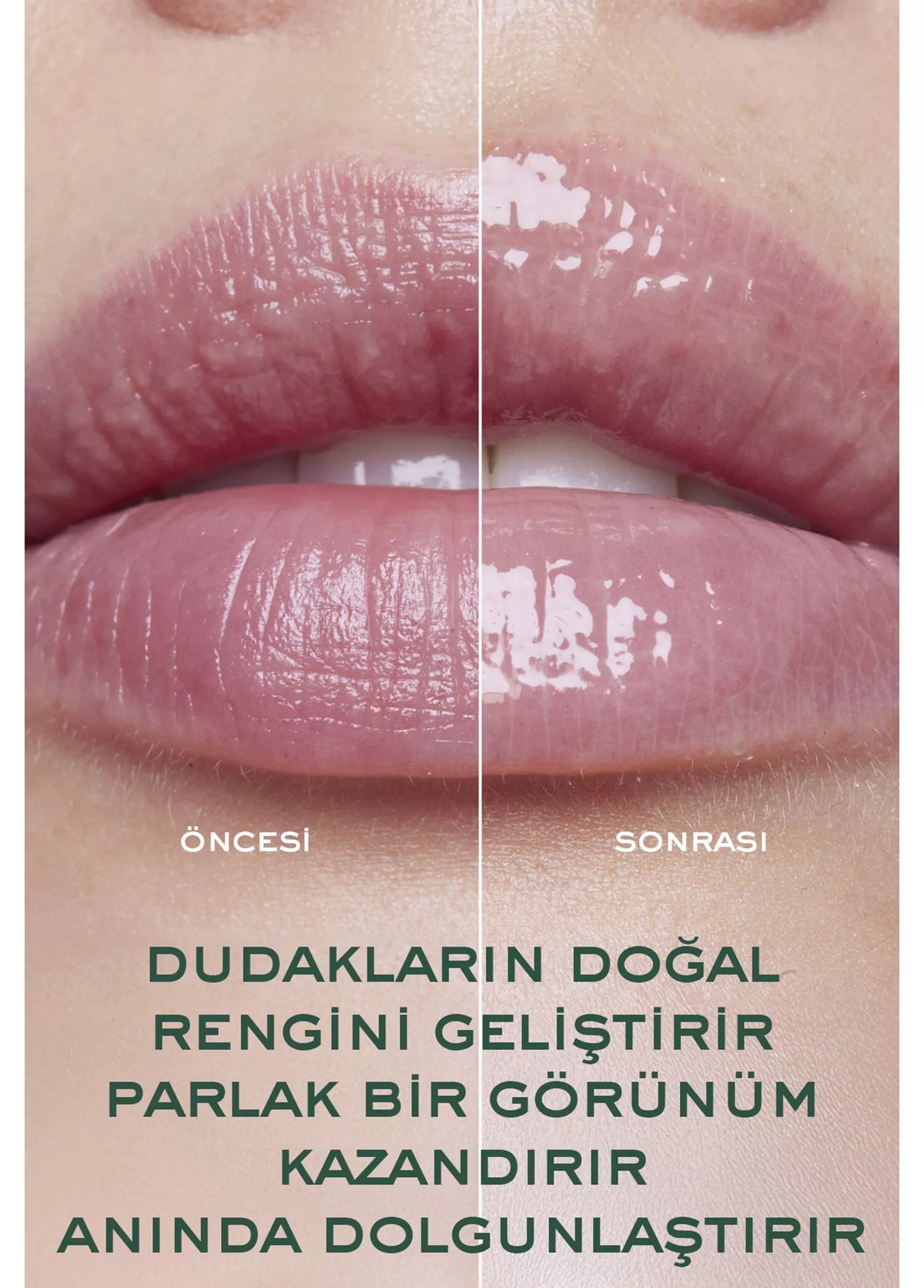 Nuxe Very Rose Dolgunlaştırıcı Dudak Serumu 8 ml - Çantalı