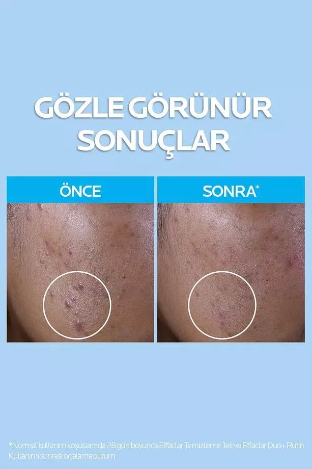 Urun gorseli