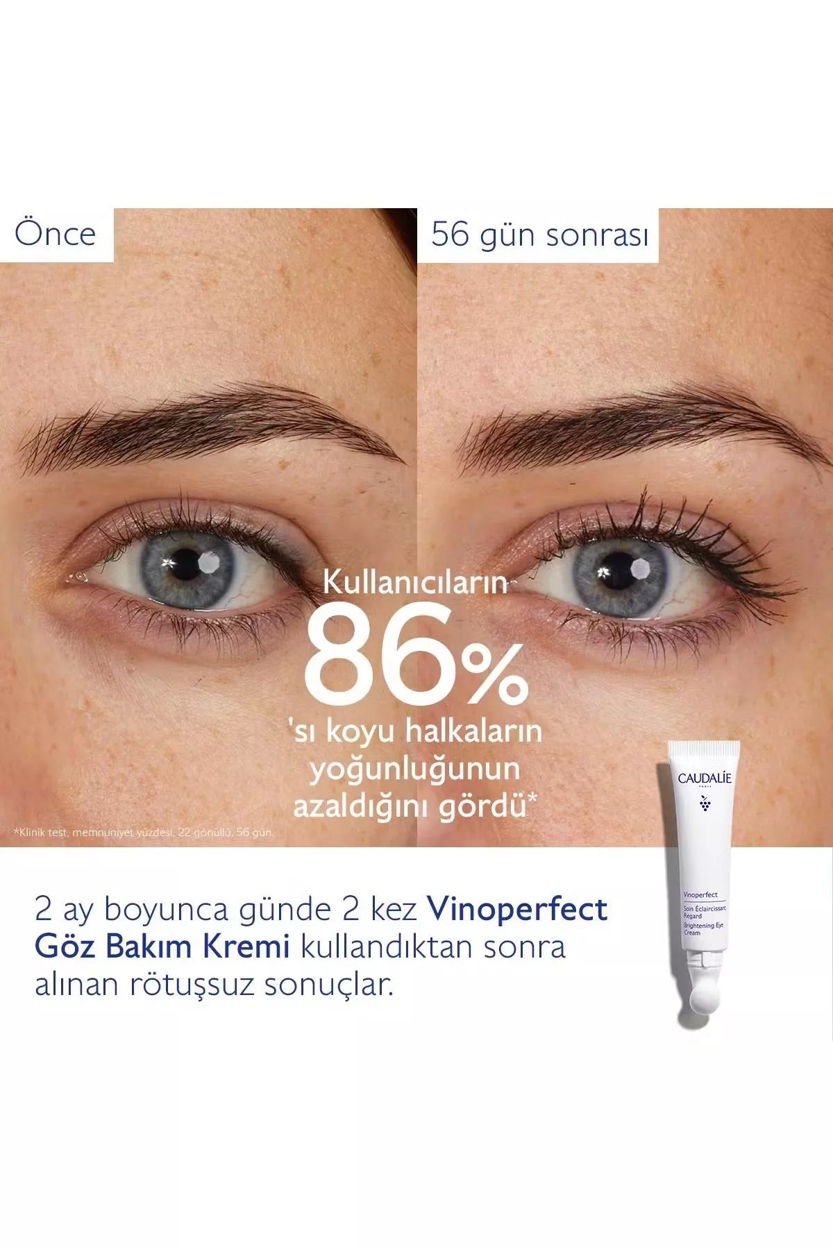 Urun gorseli