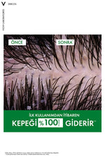 Urun gorseli