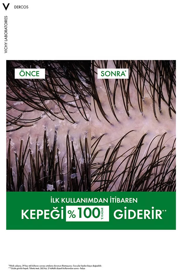 Urun gorseli