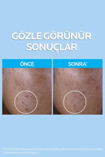 Urun gorseli