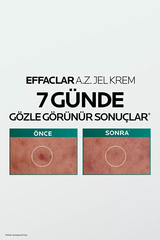 Urun gorseli