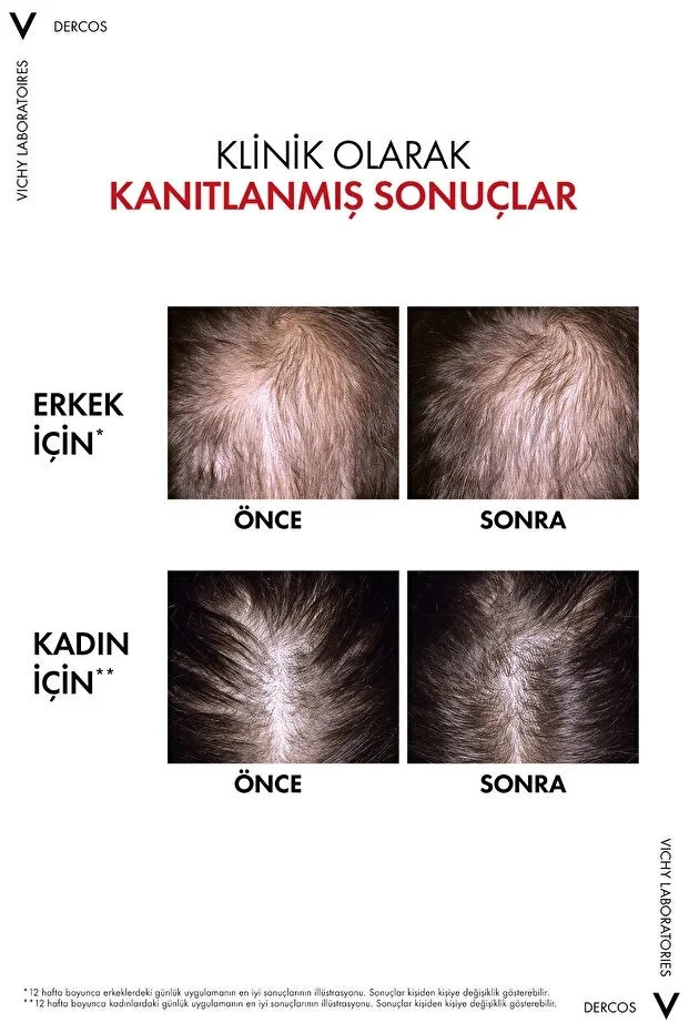 Urun gorseli