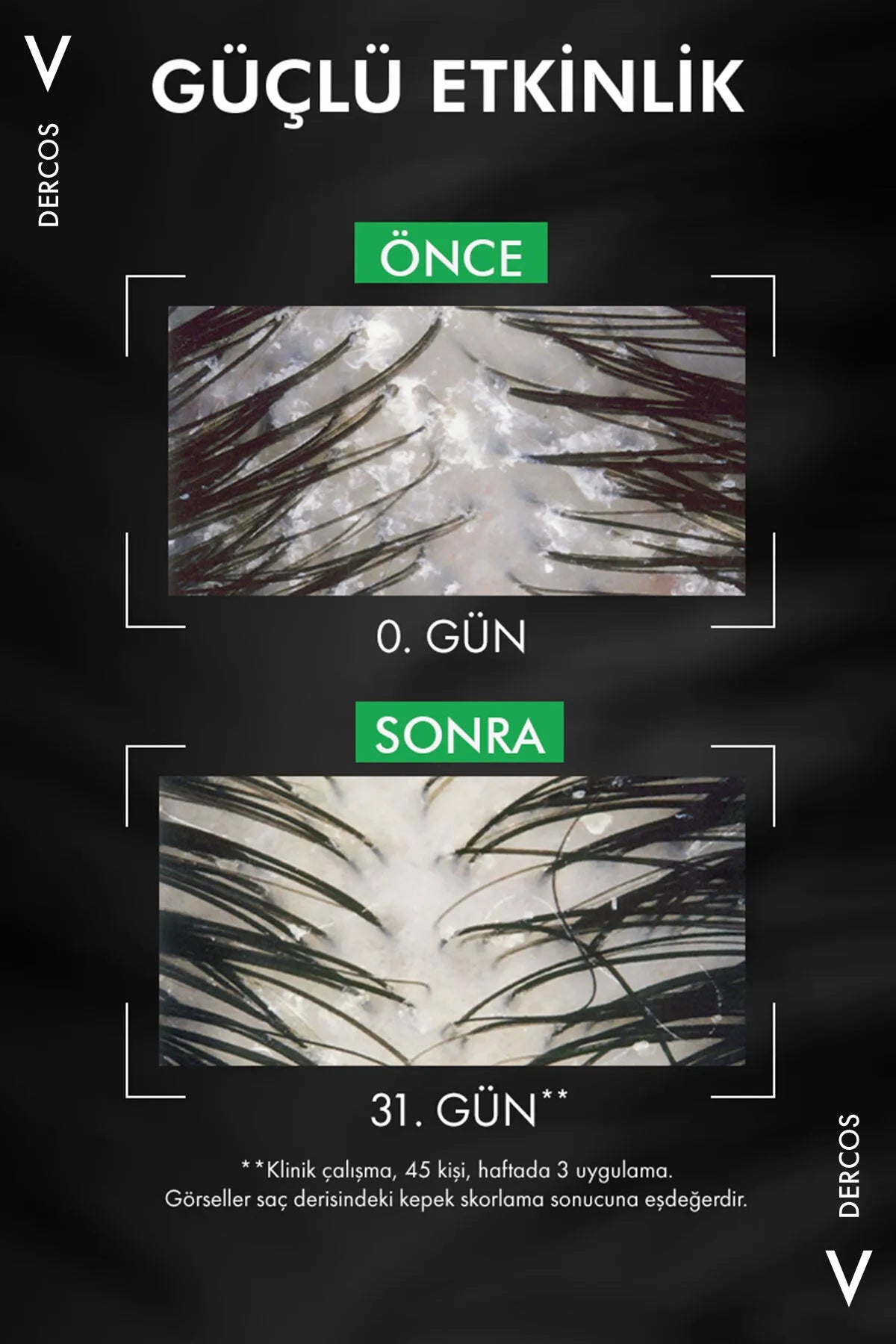 Urun gorseli