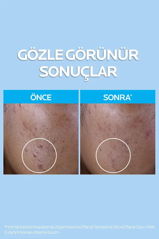 Urun gorseli