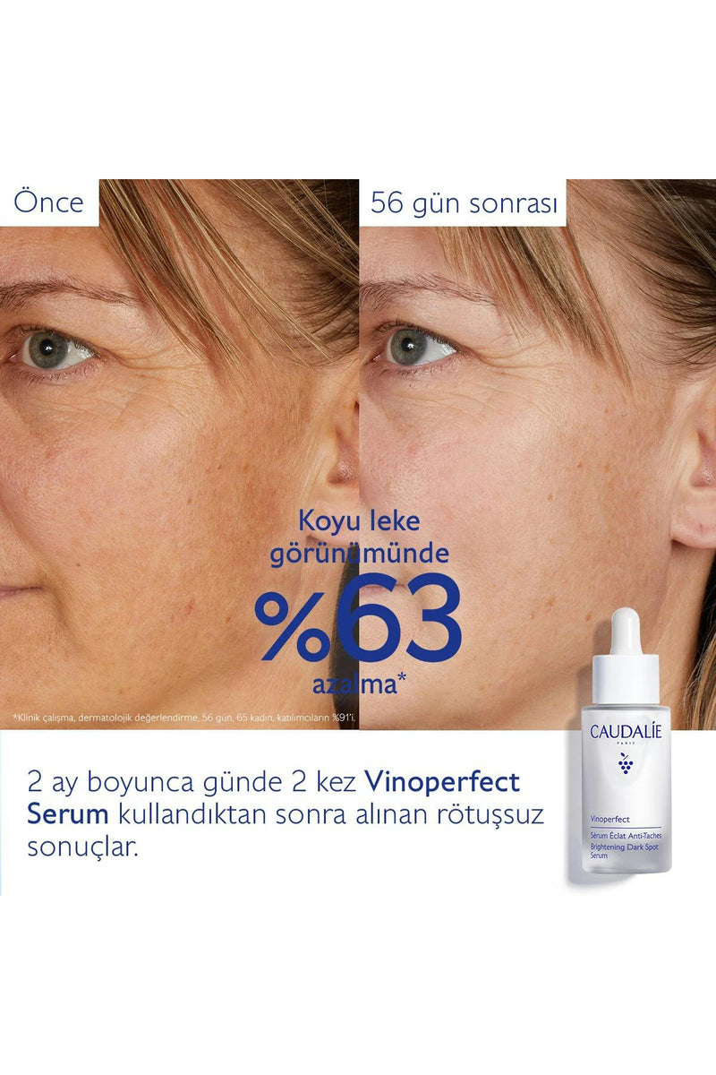 Urun gorseli