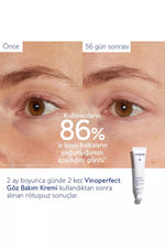 Urun gorseli
